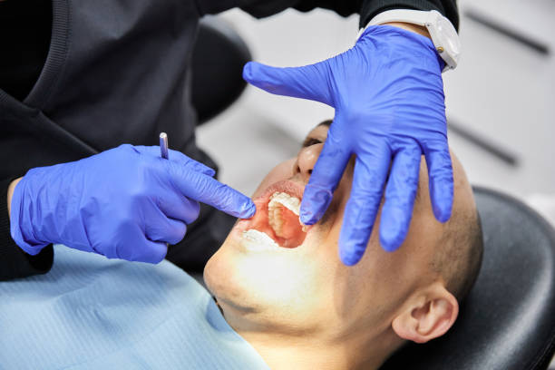 Best Dentist for Tooth Abscess  in Remerton, GA